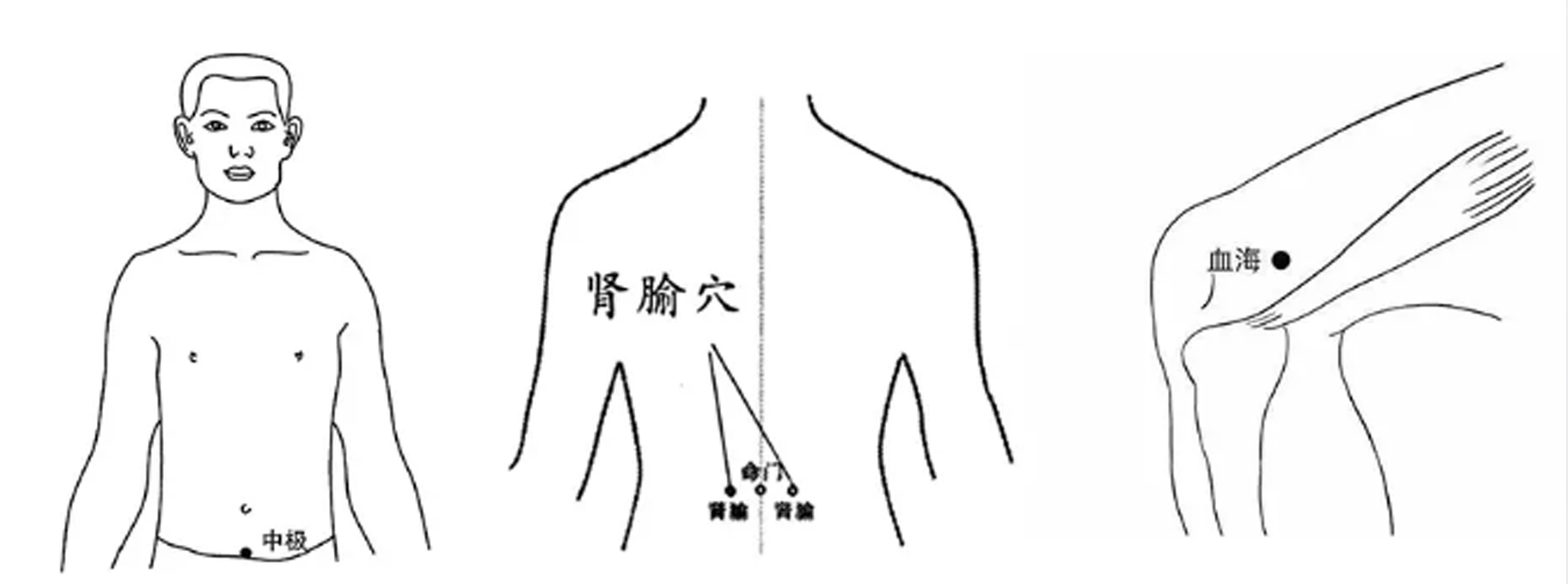 【艾灸课程第1期】子宫肌瘤,乳腺增生怎么艾灸?